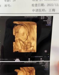 -济南艾玛妇产医院