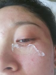 -美丽人生祛斑扁平疣汗管瘤中心