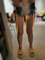 体验前-JUVA郑州欧华医疗美容医院