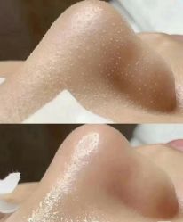 -美肤盾祛痘·问题肌头疗管理中心