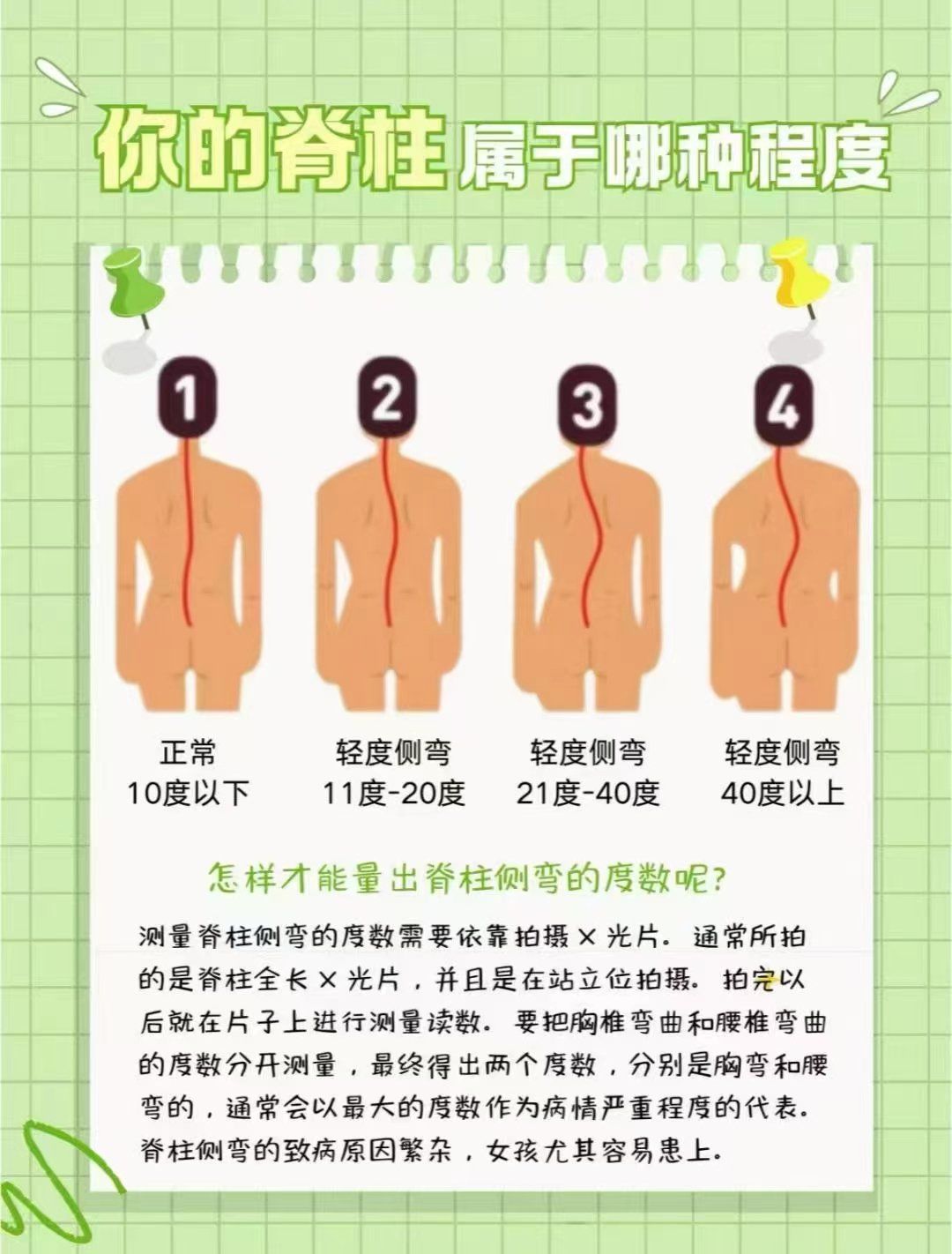 脊柱侧弯科普小知识