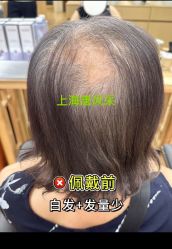 -唐风采假发补发定制