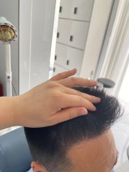 -大麦微针植发丨全国连锁