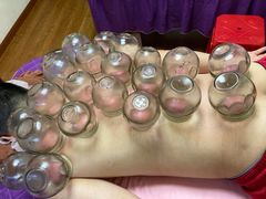 -沈师傅盲人按摩工作室(密三小区店)
