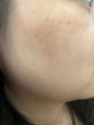 -广州美莱医疗美容医院