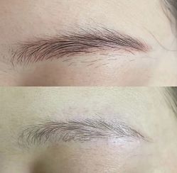 -郡艺医疗美容·微整·眼鼻吸脂