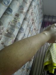 点击看大图 -薇兰专业脱毛连锁机构