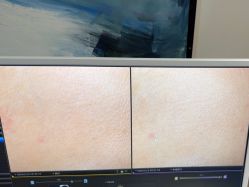-苑苑vbeauty科技美容SPA