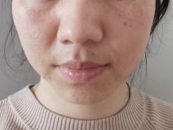 体验前-BR光电保养