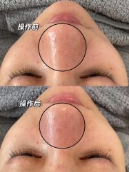 -LUNA皮相美·骨相美高级美感