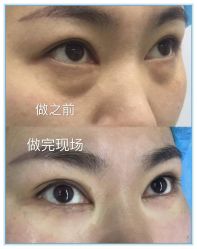 -紫洁俪方（北京）医疗美容