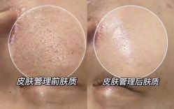 -美肤盾祛痘·问题肌头疗管理中心