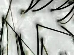-LESSMORE科技头皮理容中心