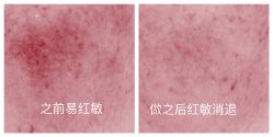 -深圳芙必优医疗美容·抗衰中心