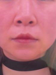 -Yestar艺星医疗美容医院