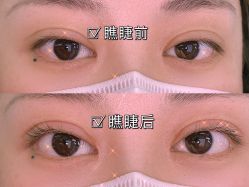-OnFaer.纹眉半永久无创洗眉