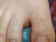 -祖传修脚甲沟炎灰指甲鸡眼