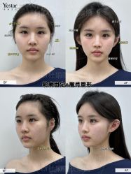 -Yestar艺星整形美容医院