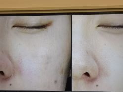 -苑苑vbeauty科技美容SPA