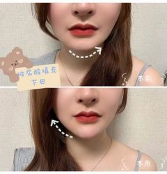 点击看大图 -深圳美莱医疗美容医院