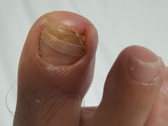 -新甲连锁灰指甲·甲沟炎·鸡眼(黑龙江路店)