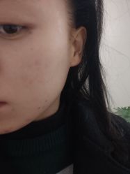 点击看大图 体验前-重庆军科整形美容医院