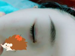 体验后-华臣医疗美容