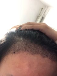 -雍禾植发全国连锁