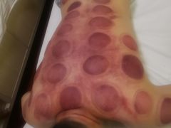 -赵氏盲人按摩(武林门店)