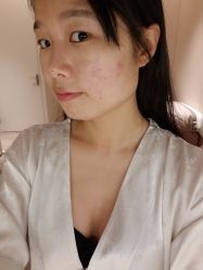 -美壹生诊所皮肤管理中心·海菲秀&Legacy美白舱