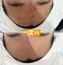 -康美贞·痘肌养护管理中心
