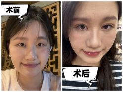 -素美医疗美容·西南眼鼻整形·修复基地