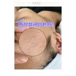 -康美贞·痘肌养护管理中心