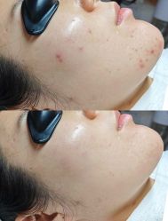 -美愈美肤MEIYU SKIN