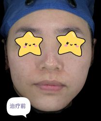 体验前-针美汇欧邦医疗美容