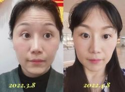 -Yestar艺星医疗美容医院