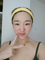 体验后-禾美嘉医疗美容