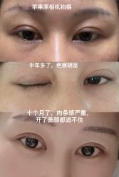 体验后-深圳艺星医疗美容医院