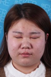 -天津伊美尔医疗整形美容专科医院