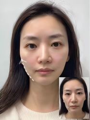 -上海伊莱美医疗美容医院