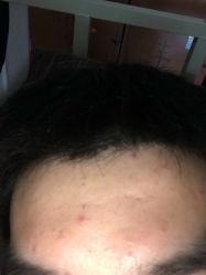 点击看大图 -痘院士专业祛痘皮肤管理