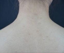 -厦门美莱整形美容医院