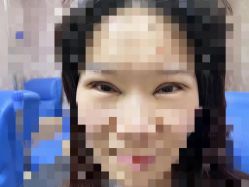 体验后-郑州米兰柏羽集美医疗美容医院