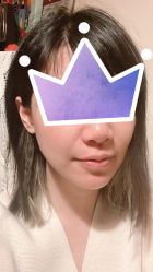 体验后-JS医疗美容