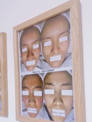 -美肤盾祛痘·问题肌头疗管理中心