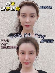 -颜和骨正·明哲式骨相美学整骨