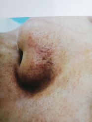 -蕾特恩专业祛痘·皮肤管理