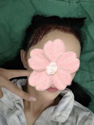 点击看大图 -大麦微针植发全国连锁