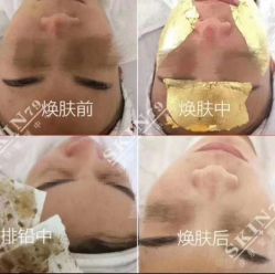 点击看大图 -skin79皮肤管理基站