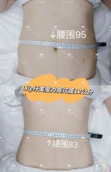-Lily纤美·科技减脂中心